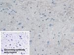 MYO1D Antibody in Immunohistochemistry (Paraffin) (IHC (P))