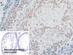 MYO1D Antibody in Immunohistochemistry (Paraffin) (IHC (P))