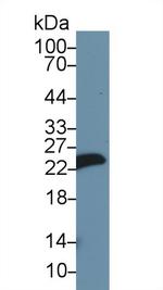 MYL1 Antibody in Western Blot (WB)