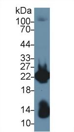 MYL1 Antibody in Western Blot (WB)