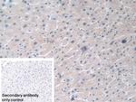MX1 Antibody in Immunohistochemistry (Paraffin) (IHC (P))