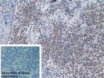 MX1 Antibody in Immunohistochemistry (Paraffin) (IHC (P))