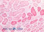 NAGLU Polyclonal Antibody