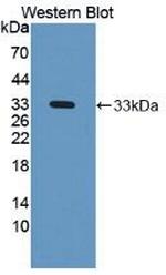 NAGLU Antibody in Western Blot (WB)