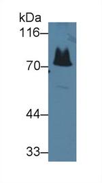 MT-ND5 Antibody in Western Blot (WB)