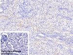NDUFS1 Antibody in Immunohistochemistry (Paraffin) (IHC (P))