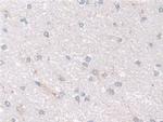NDUFS1 Antibody in Immunohistochemistry (Paraffin) (IHC (P))