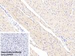 NDUFS1 Polyclonal Antibody