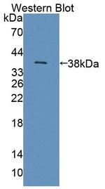 CD336 (NKp44) Antibody in Western Blot (WB)