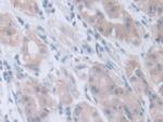 INVS Polyclonal Antibody