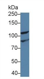INVS Antibody in Western Blot (WB)