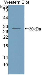INVS Antibody in Western Blot (WB)