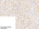 NOVA1 Polyclonal Antibody