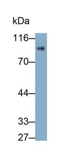 Nexilin Antibody in Western Blot (WB)