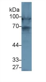 Nexilin Antibody in Western Blot (WB)