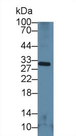 NNMT Antibody in Western Blot (WB)
