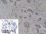 NOSIP Polyclonal Antibody