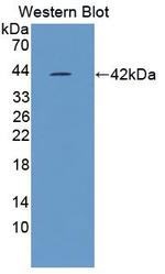 NLRP3 Antibody in Western Blot (WB)