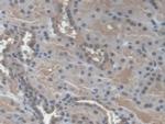 NME3 Polyclonal Antibody