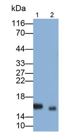 NME3 Antibody in Western Blot (WB)