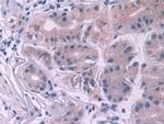 NOTCH2NL Antibody in Immunohistochemistry (Paraffin) (IHC (P))