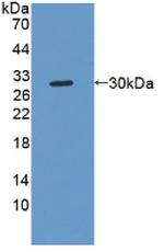 NOTCH2NL Antibody in Western Blot (WB)