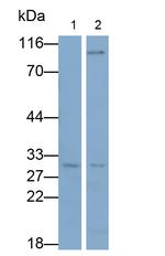 NOTCH2NL Antibody in Western Blot (WB)