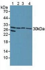 NOTCH2NL Antibody in Western Blot (WB)