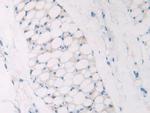NPM1 Antibody in Immunohistochemistry (Paraffin) (IHC (P))