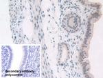 NPM1 Antibody in Immunohistochemistry (Paraffin) (IHC (P))