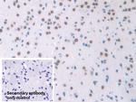 NPM1 Antibody in Immunohistochemistry (Paraffin) (IHC (P))