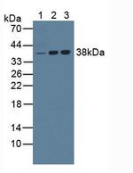 NPM1 Antibody in Western Blot (WB)