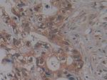 NUP155 Polyclonal Antibody