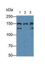 NUP155 Antibody in Western Blot (WB)