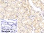 NUMB Polyclonal Antibody