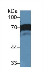 NUMB Antibody in Western Blot (WB)