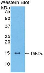 NUMB Antibody in Western Blot (WB)