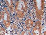MGMT Antibody in Immunohistochemistry (Paraffin) (IHC (P))