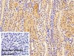 MGMT Antibody in Immunohistochemistry (Paraffin) (IHC (P))