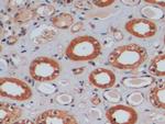 MGMT Antibody in Immunohistochemistry (Paraffin) (IHC (P))