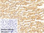 MGMT Antibody in Immunohistochemistry (Paraffin) (IHC (P))