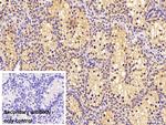 MGMT Polyclonal Antibody