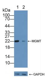 MGMT Antibody in Western Blot (WB)