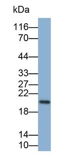 MGMT Antibody in Western Blot (WB)