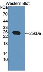 MGMT Antibody in Western Blot (WB)