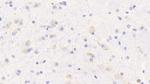OPHN1 Polyclonal Antibody