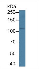 OSMR Antibody in Western Blot (WB)