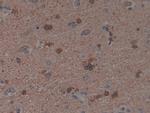 PAK1 Polyclonal Antibody