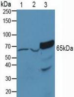 PAK1 Antibody in Western Blot (WB)