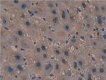 PAK2 Antibody in Immunohistochemistry (Paraffin) (IHC (P))